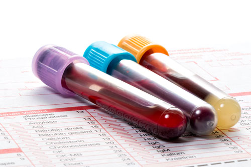 Health Tests Direct makes expensive laboratory blood tests cheaper to buy!